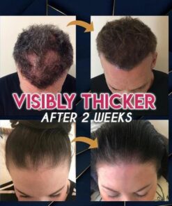 Pure Grow juuste kasvu essents