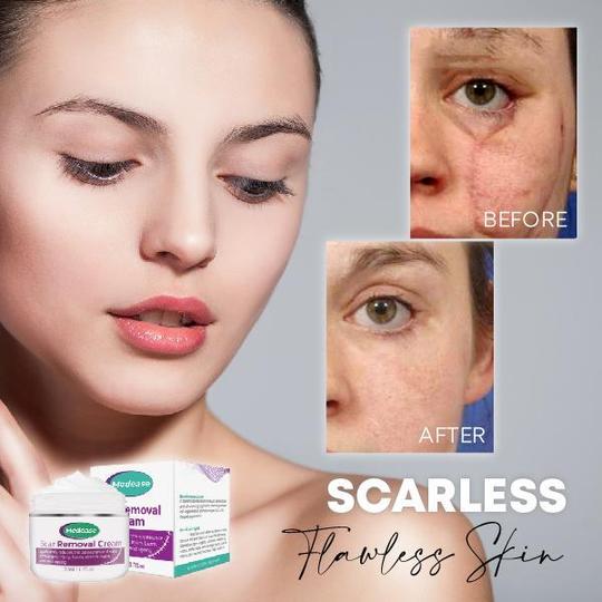 Medease Skin Rebound kreem - Image 2