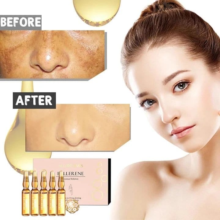 Valgendav plekivaba ampullseerum (7 tk) - Image 2