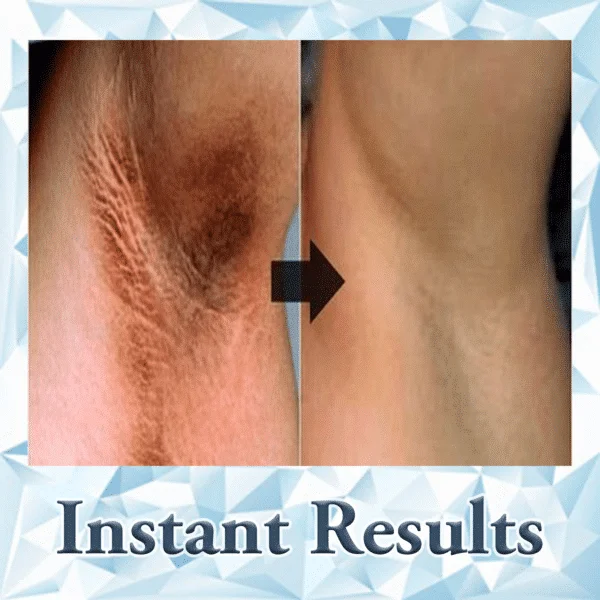 ROLLY Sasheri kollektsioon (30 tasuta kinnitatavat klippi) - Image 6