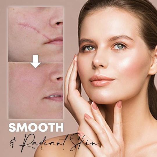 Medease Skin Rebound kreem - Image 3