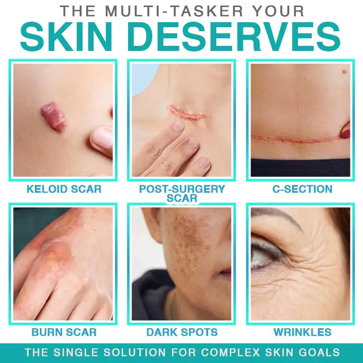 𝗖𝗮𝗿𝗲𝗕𝗿𝗲𝗲𝘇𝗲® 3-in-1 mikronõela hooldusplaaster - Image 2