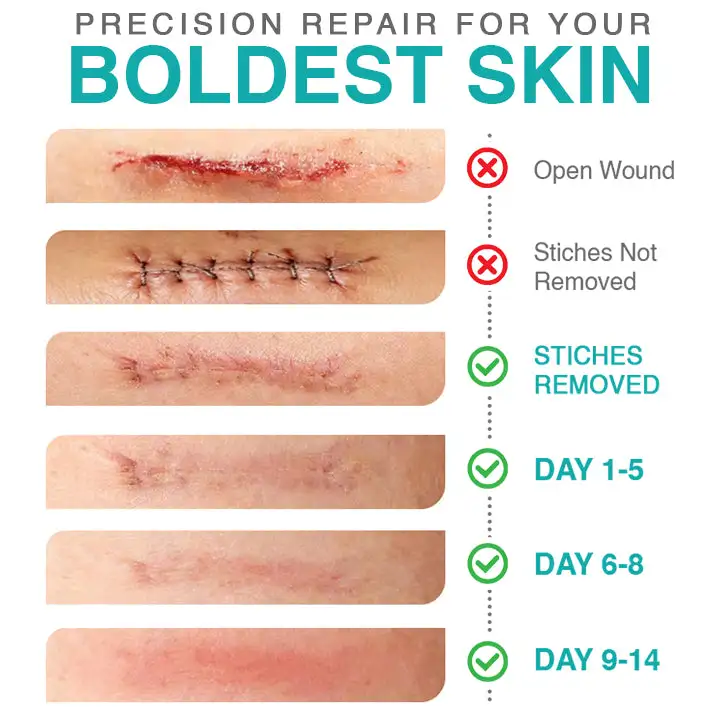 𝗖𝗮𝗿𝗲𝗕𝗿𝗲𝗲𝘇𝗲® 3-in-1 mikronõela hooldusplaaster - Image 4