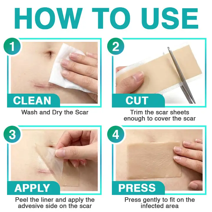 𝗖𝗮𝗿𝗲𝗕𝗿𝗲𝗲𝘇𝗲® 3-in-1 mikronõela hooldusplaaster - Image 7