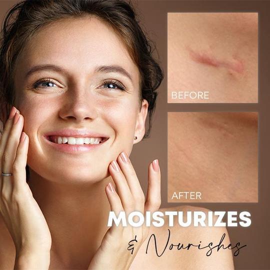 Medease Skin Rebound kreem - Image 4