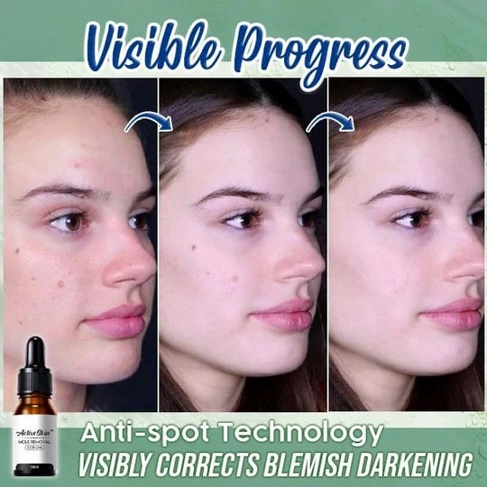 ActiveSkin mutieemaldusseerum - Image 4