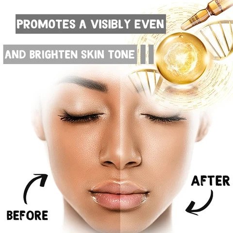 Valgendav plekivaba ampullseerum (7 tk) - Image 4