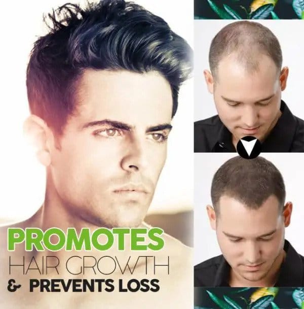 Orgaaniline juuste tumenemise lahus - Image 3