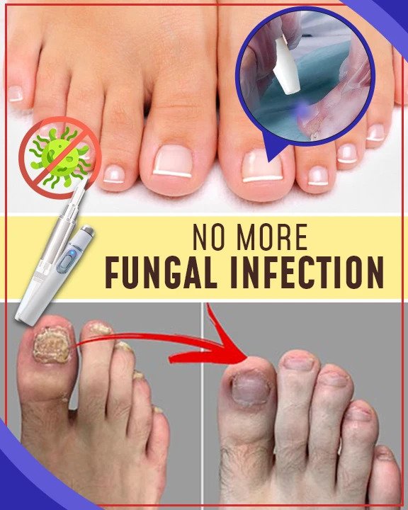 Seenevastased sinise valguse ravikomplektid - Image 3