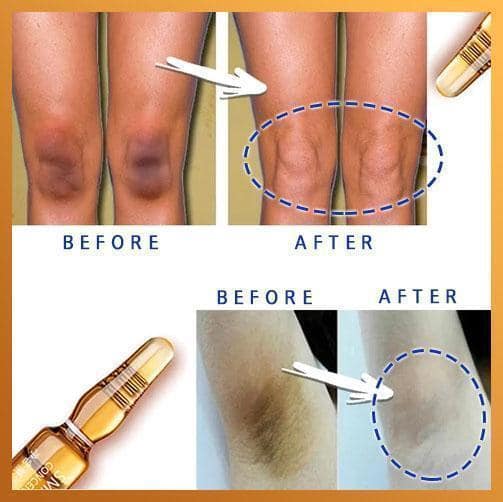 Instant Dark Spot Lifting Ampull - Image 4