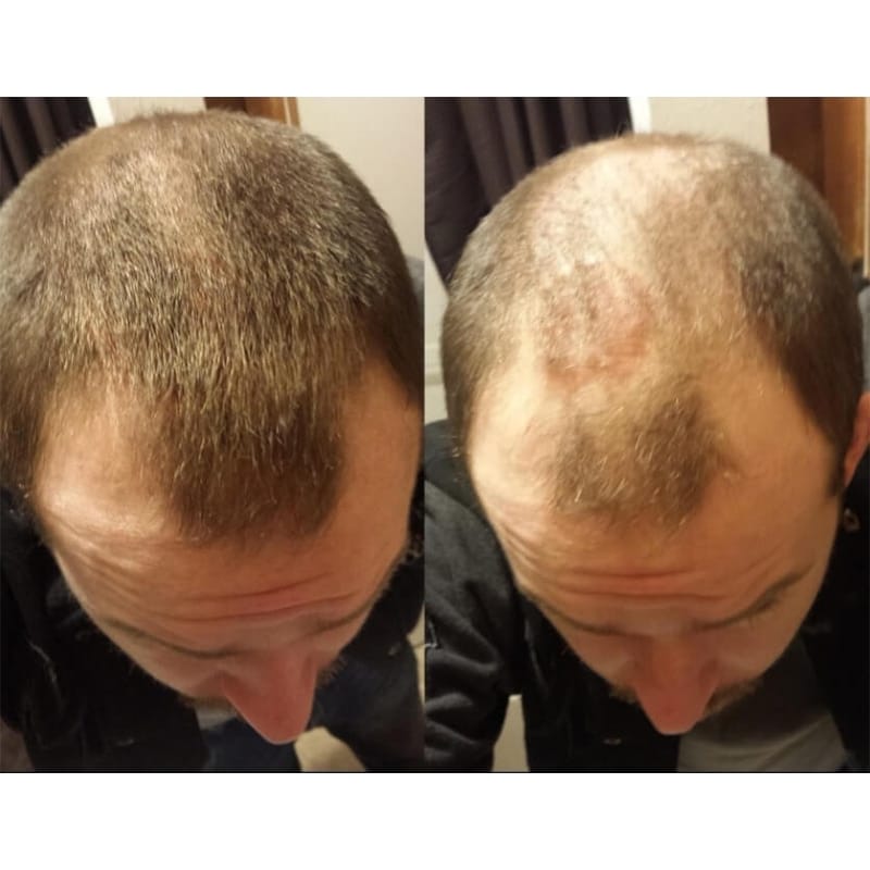 Juuste ehituskiud - Image 5