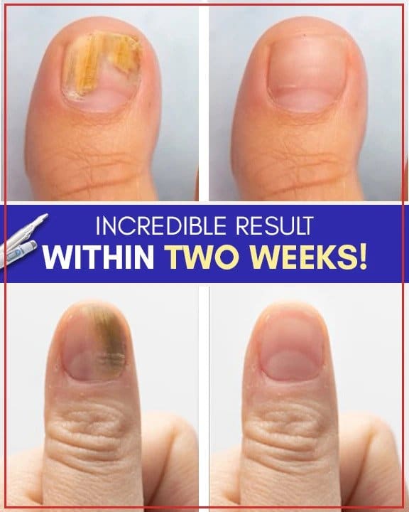 Seenevastased sinise valguse ravikomplektid - Image 5