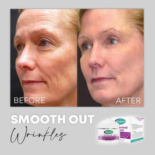 Medease Skin Rebound kreem - Image 7