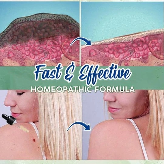 ActiveSkin mutieemaldusseerum - Image 7