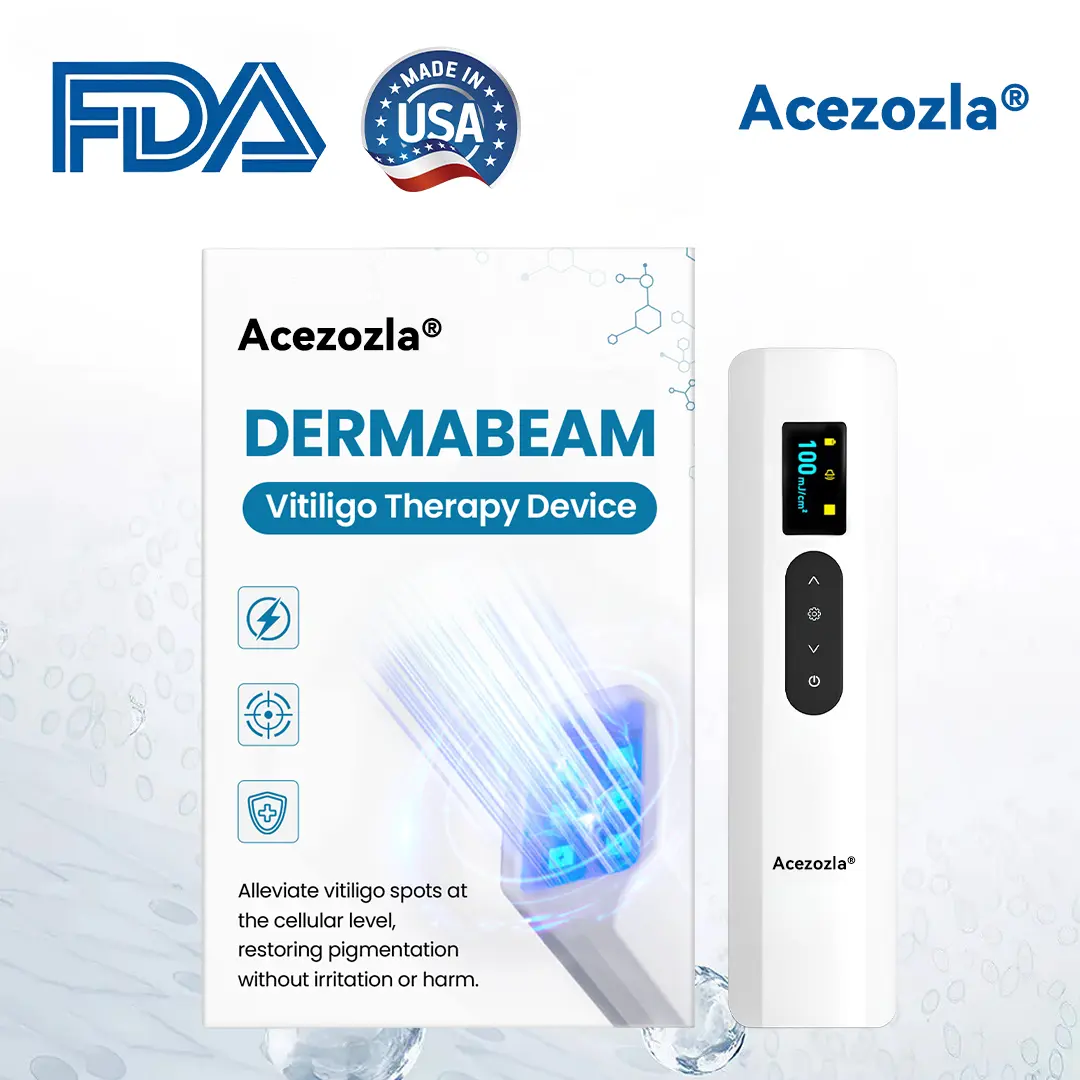 Vitiligo raviseade Acezozla® DermaBeam