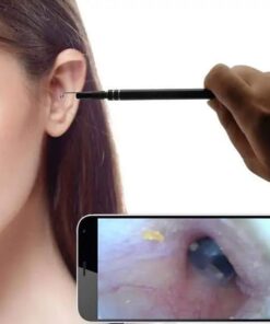 Endoskoobi kõrvakorjamise kaamera