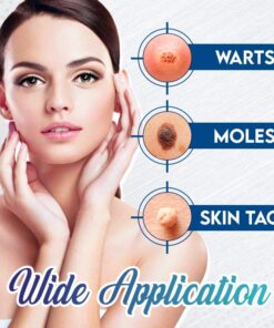 Kohene plekkide eemaldamise geel