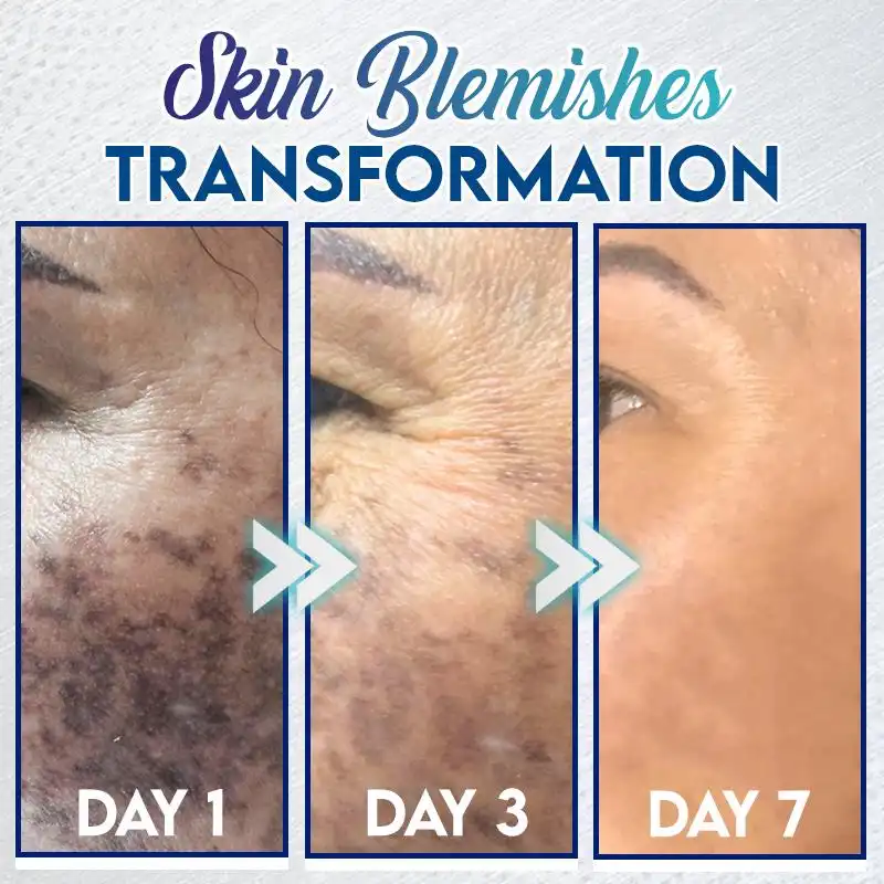 Kohene plekkide eemaldamise geel - Image 2