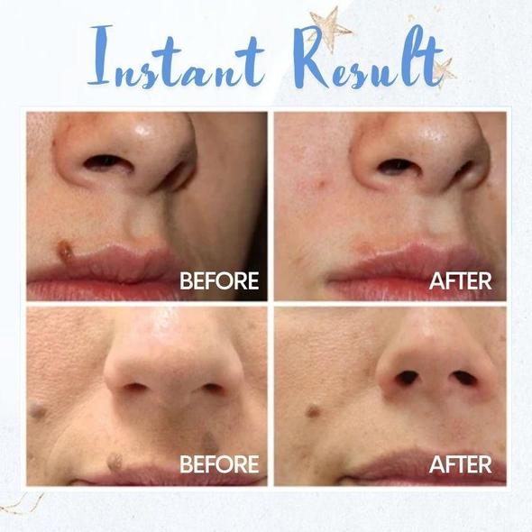 Pliiats täppide eemaldamiseks - Image 2