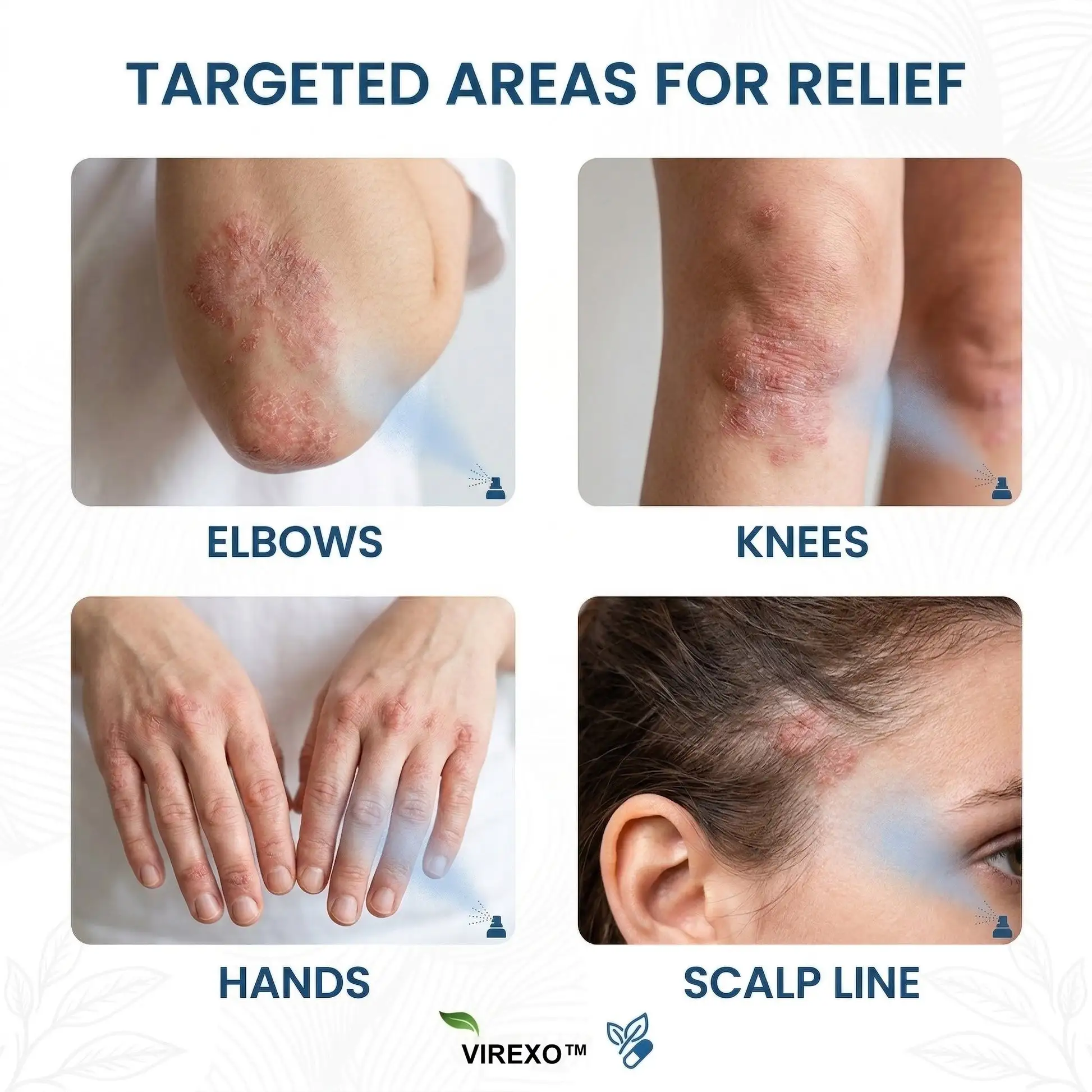 Virexo™ magneesiumi botaaniline pihusti - Image 2