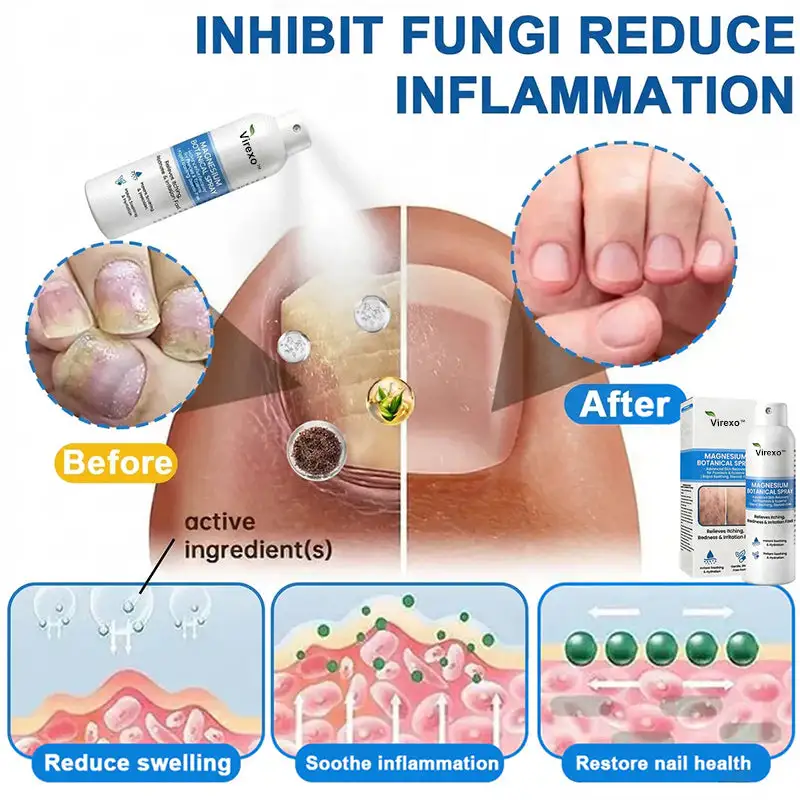 Virexo™ magneesiumi botaaniline pihusti - Image 4