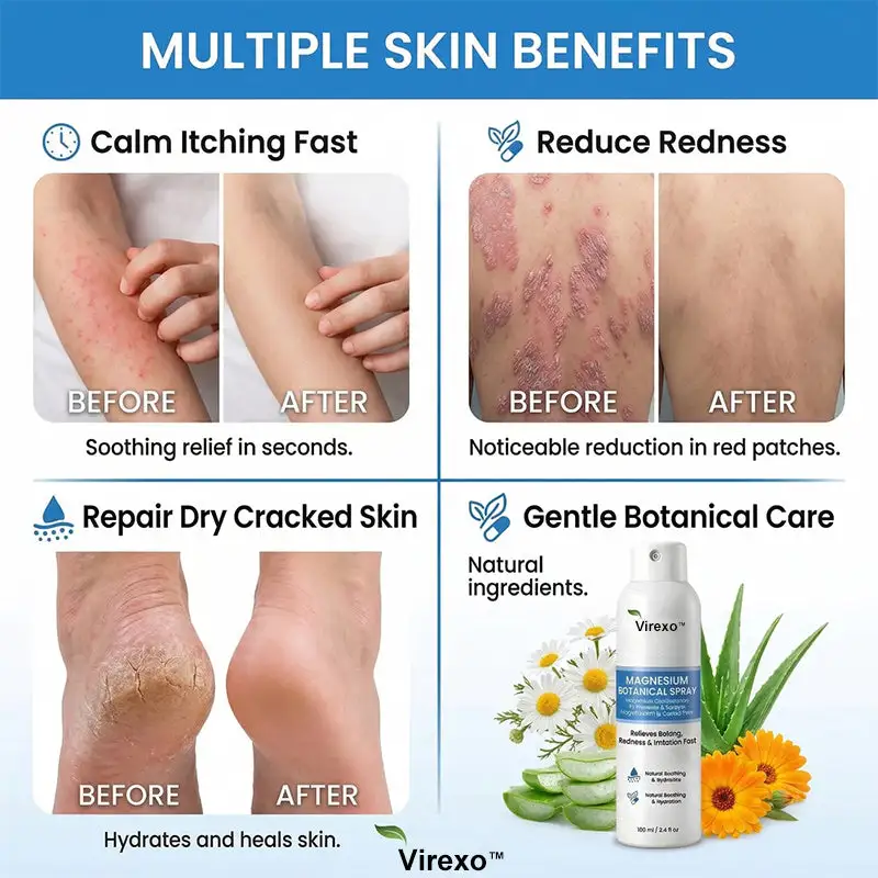 Virexo™ magneesiumi botaaniline pihusti - Image 9