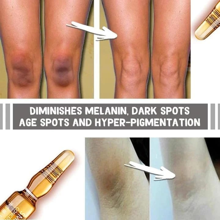 Valgendav plekivaba ampullseerum (7 tk) - Image 3